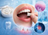 can nicotine pouches cause oral health changes