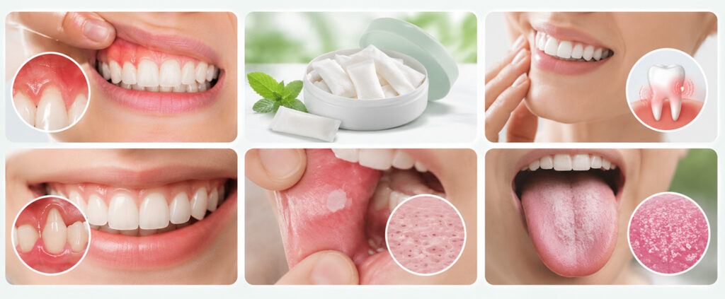 oral health risks