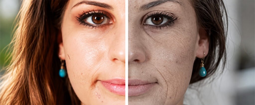 facial signs of aging